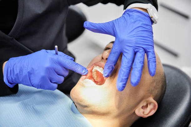 Best Cracked Tooth Emergency Dentist  in Hillsbo, OR